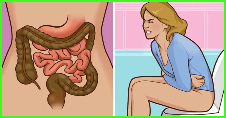 Constipation and How to Get Rid of it