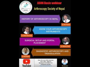 basics of arthroscopy ason webin