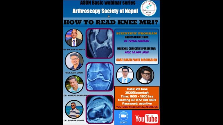 How to Read Knee MRI | ASON Webinar 7