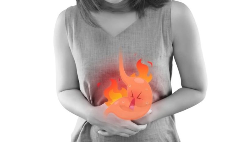Heartburn Symptoms Precautions With Spicy Foods