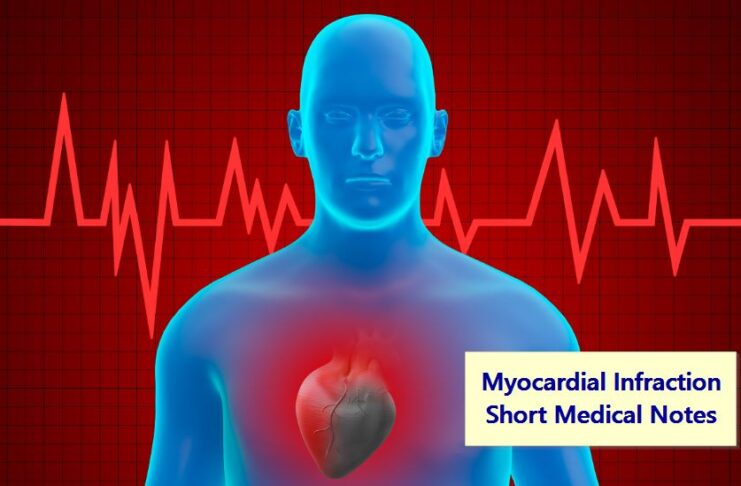 Myocardial Infraction Short Medical Notes