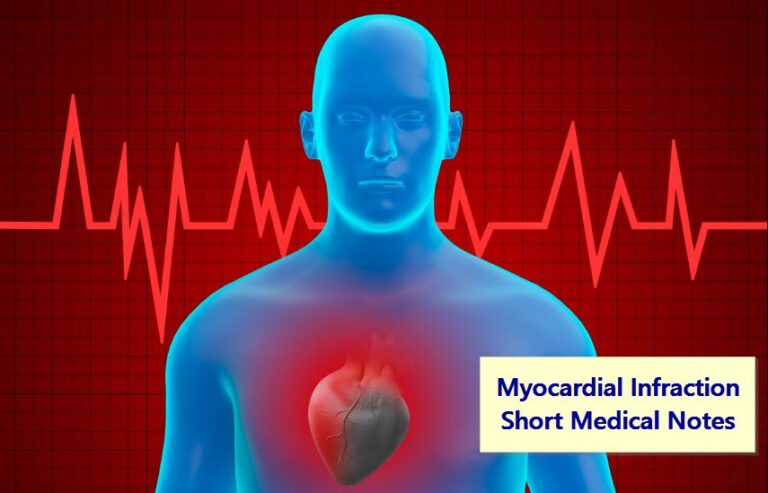 Myocardial Infraction Short Medical Notes