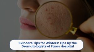 winter skincare tips paras hospital dermatologists guide