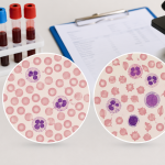 Normal and Abnormal Complete Blood Count With Differential